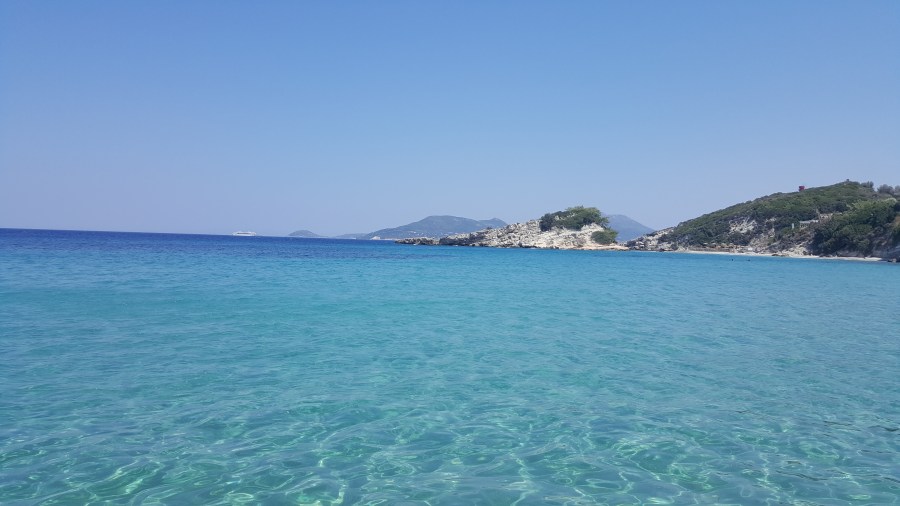 Bu manzaraya o yemek yakışmadı...